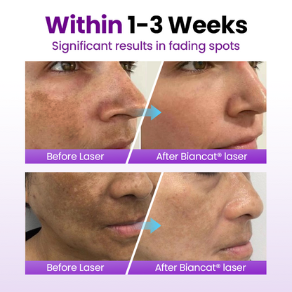 SpotErase Probiotic Shield Serum