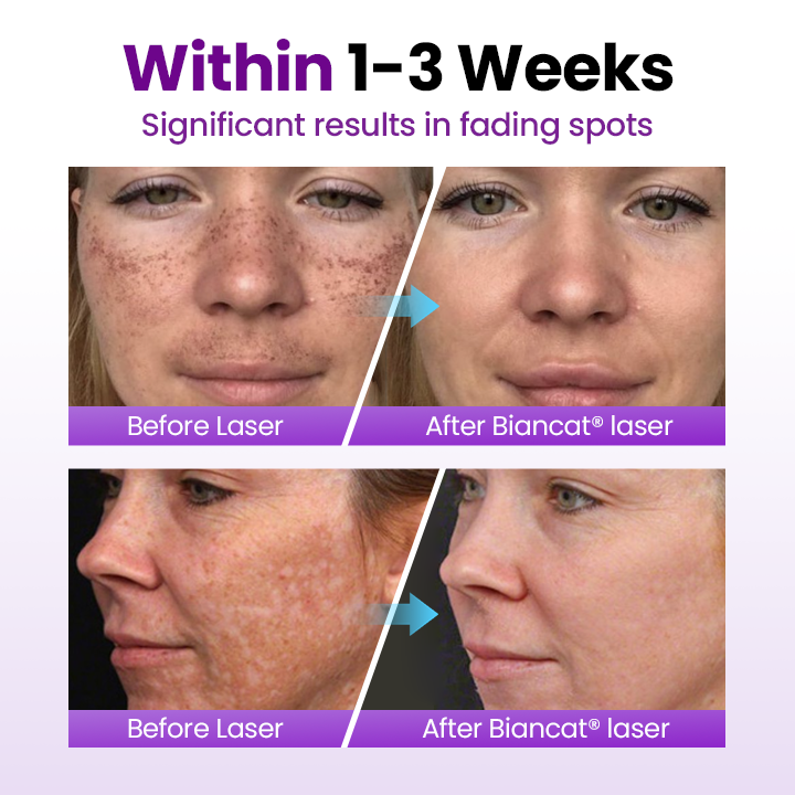 SpotErase Probiotic Shield Serum