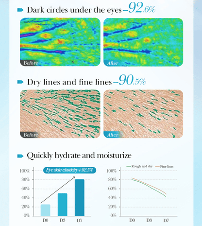 Deep Collagen Hydrogel Eye Patches (5 Pairs) - Anti-Aging Mask to Depuff Under-Eyes, Firm Drooping Eyelids & Boost Moisture👀💧