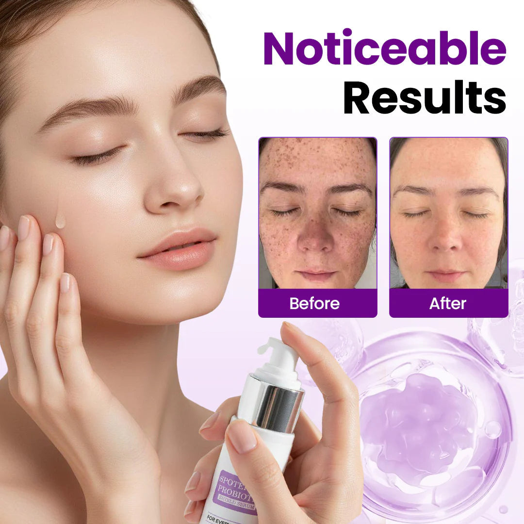 SpotErase Probiotic Shield Serum
