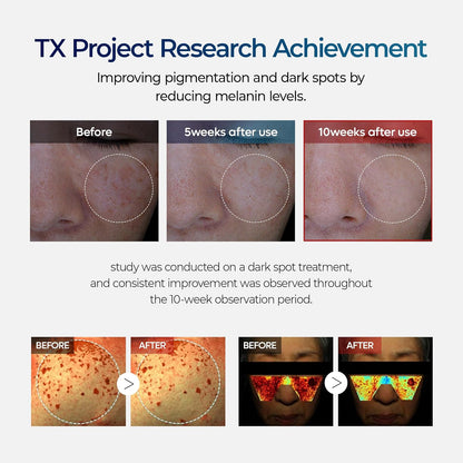 💜Official Authorized |🧴TX Tranexamic Acid Cream