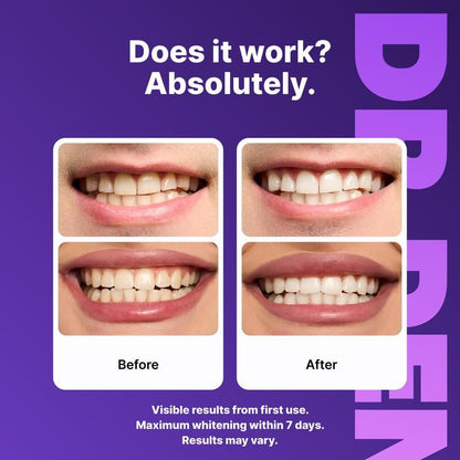 🦷Purple Teeth Whitening Strips - 21 Whitening Sessions - Safe for Enamel - Non Sensitive Teeth Whitening - Peroxide-Free