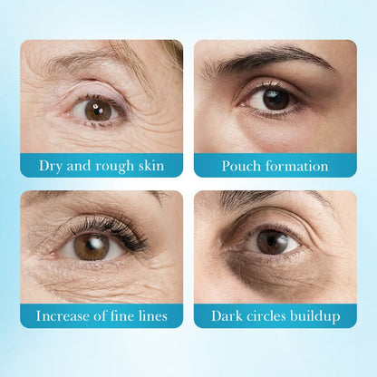 Deep Collagen Hydrogel Eye Patches (5 Pairs) - Anti-Aging Mask to Depuff Under-Eyes, Firm Drooping Eyelids & Boost Moisture👀💧